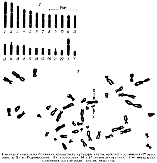 Идиограмма мужского кариотипа