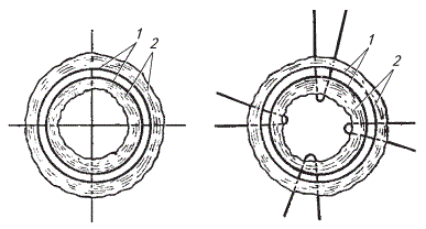 Схема наложения швов на участок прямой кишки при ее выпадении путем прошивания ее перекрестными нитями