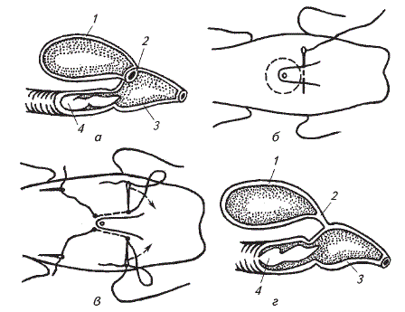 Схема отшивания дивертикула препуциального мешка у хряка