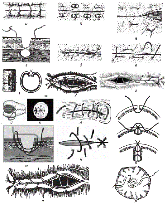 Как называется шов после операции. Кисетный шов в хирургии Ветеринария. Горизонтальный матрасный шов в хирургии. Техника наложения хирургических швов. Провизорные швы хирургия.