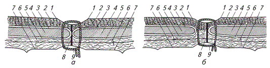 Правильно (слева) и неправильно (справа) наложенные швы на брюшной стенке при овариэктомии по белой линии
