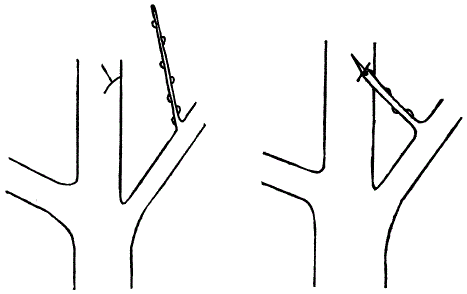 Крепление скелетной ветви со стволом при помощи прививки «мостиком»